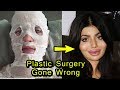 8 Bollywood Actress Plastic Surgery Gone Wrong | Then and Now