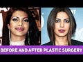 Plastic Surgery ?? ???? ?? ??? ?? 10 ??????? ???????????? | 10 Actresses Before and After Surgery